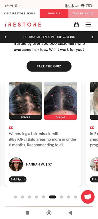 iRestore hair growth system Нискоенергийна лазерна терапия при косопад