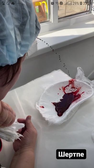 Шертпе со лба хиджама