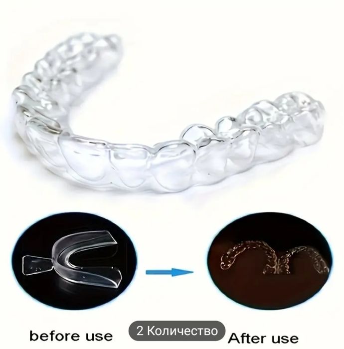 Прозрачен Предпазител За Зъби Против Бруксизъм, Предпазите