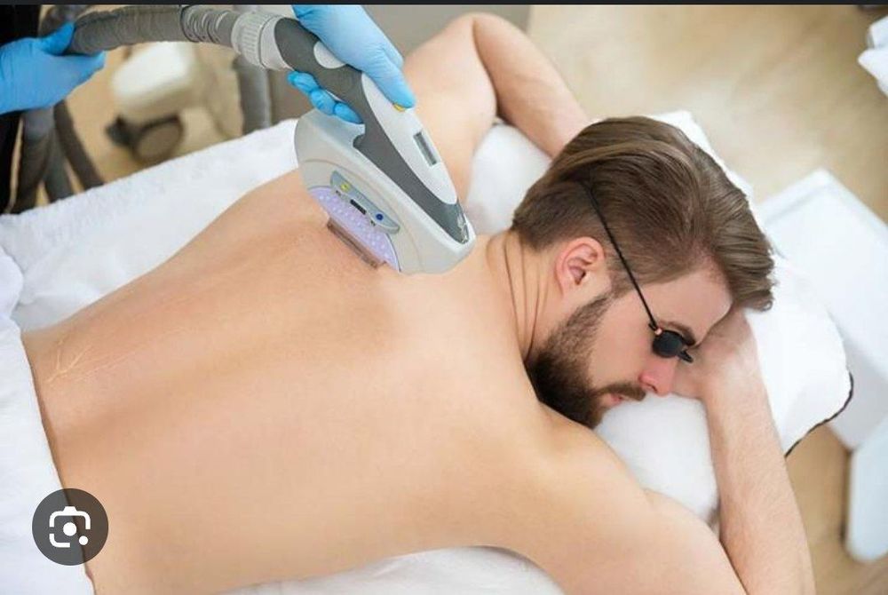 Лазерная Эпиляция для мужчин