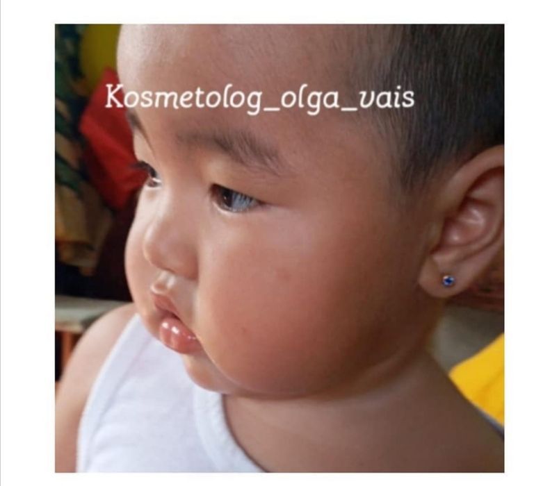 Прокол ушей Studex