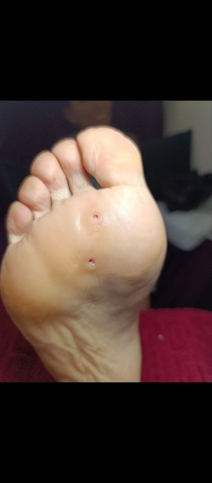 Курс на подолога, работа с проблемными ногтями