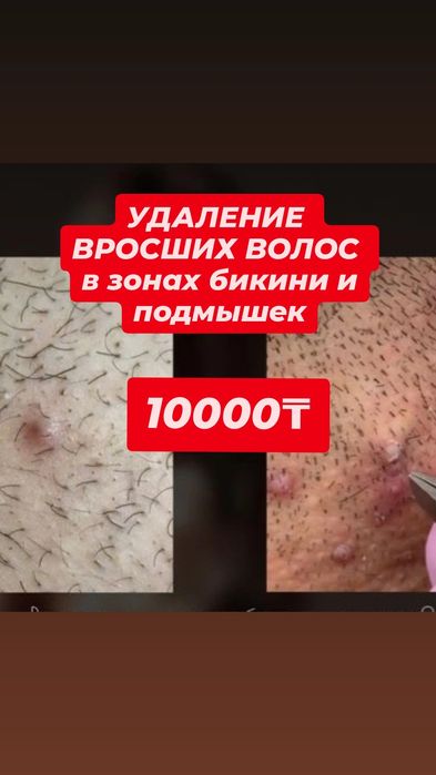 Шугаринг для мужчин