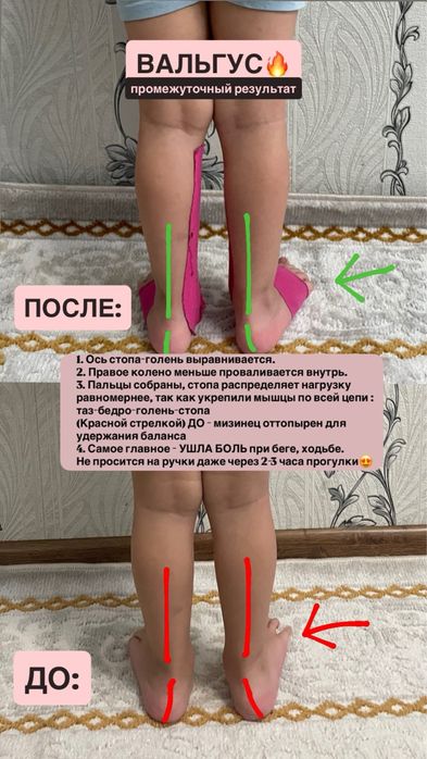Детский массажист педиатр Алматы