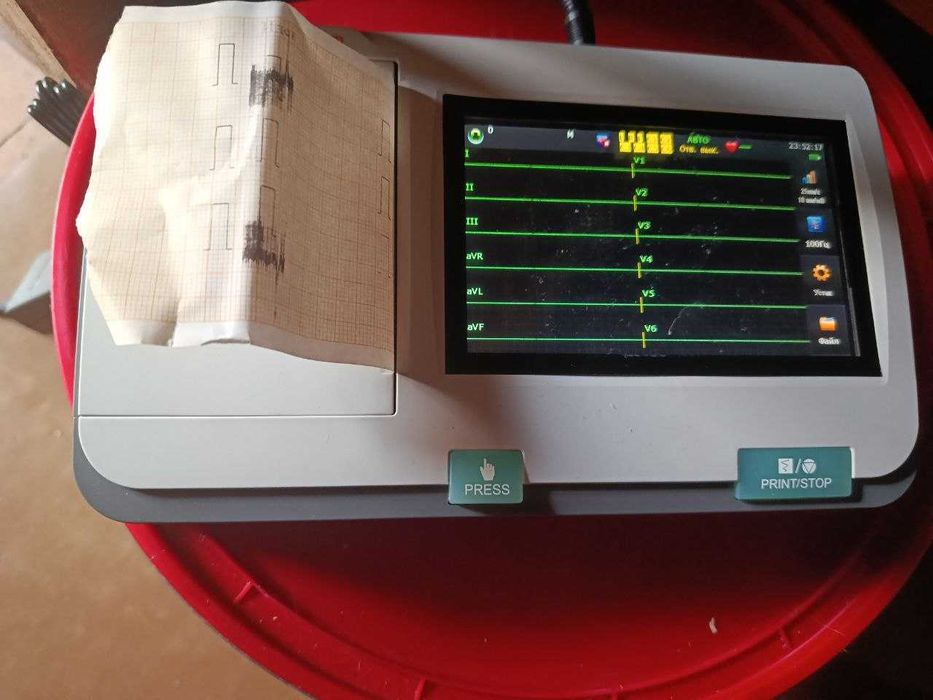 ЭКГ Электрокардиограф EDAN SE-301 B, 3-канальный с сенсорным экраном