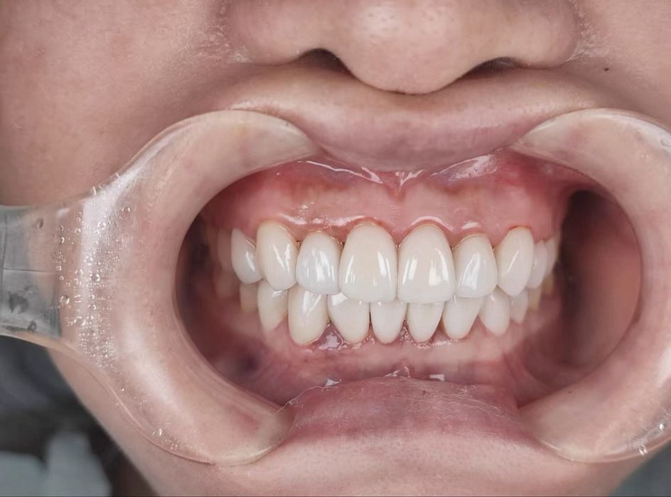 MKT-016 для дентальной фотографии