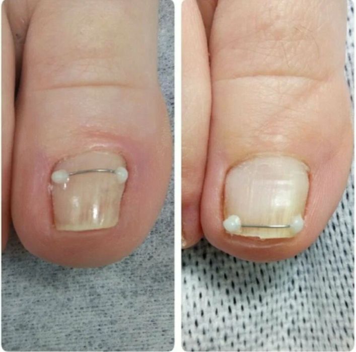 ПОДОЛОГ 22 года стаж