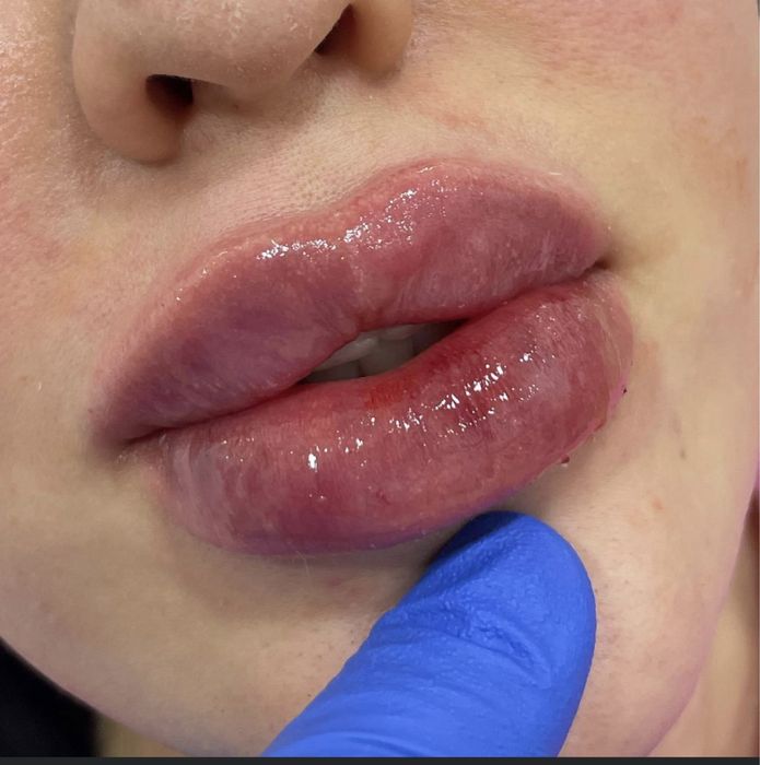 Косметолог шошиламиз кизлажонла декабр ойга  котта скидка