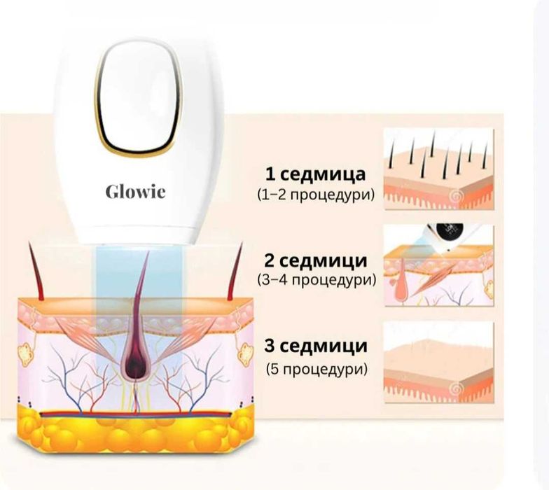 Фотоепилатор Glowie