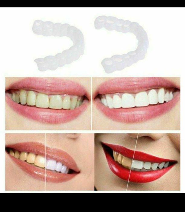 виниры для зубов