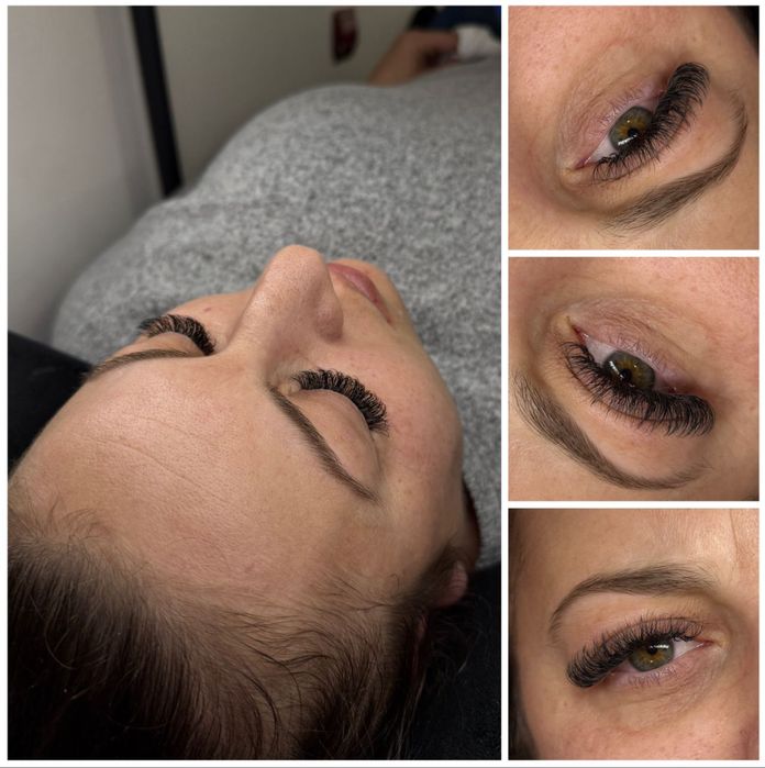 Extensii gene (1D, 2D, 3D, 4D)