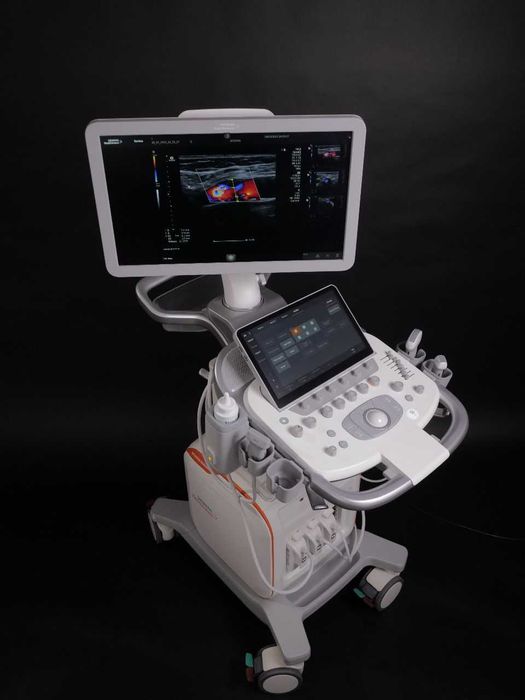 Продам узи аппарат Siemens Redwood