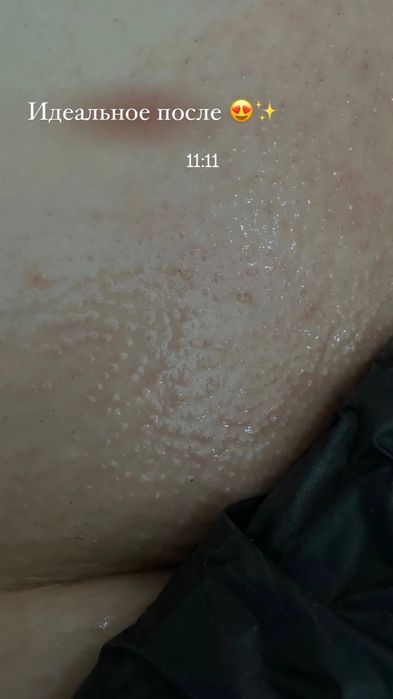 Шугаринг всего тела.