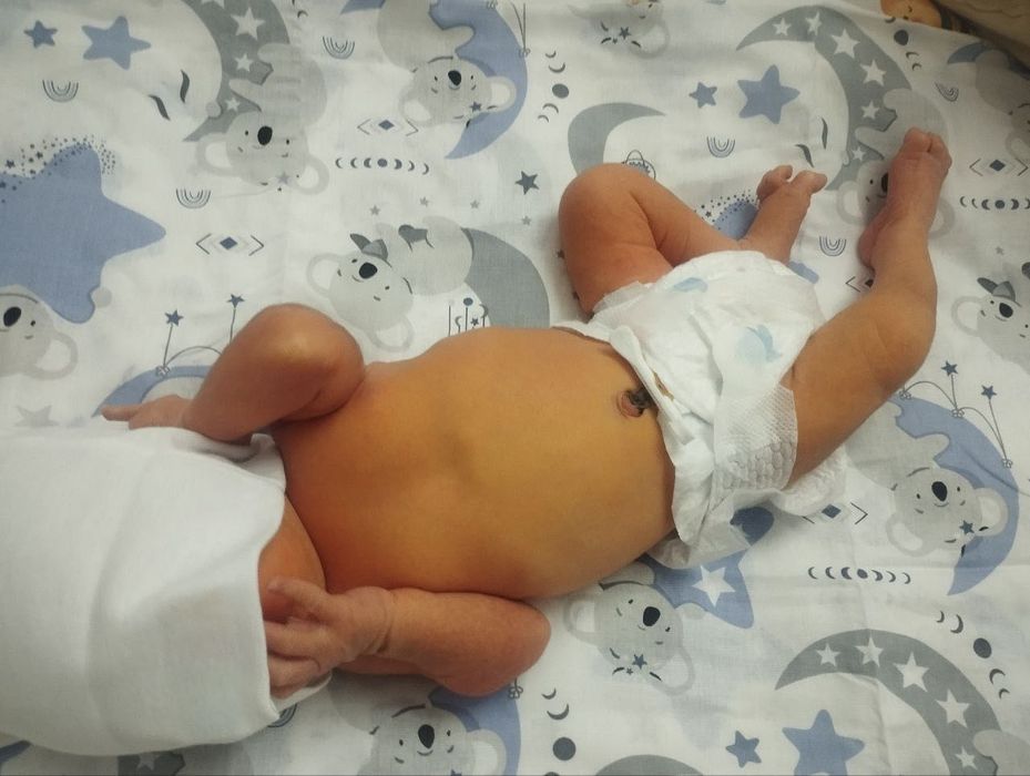 Fotolampa. Fototerapiya. Фотолампа. Фототерапия. Аренда. Ijara