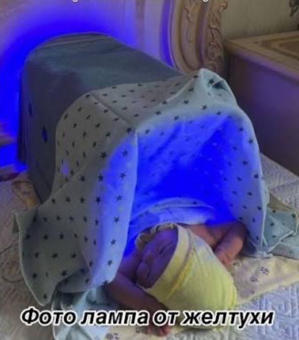 Лампа от желтушки