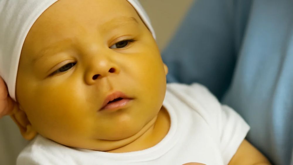 Лампа от желтушки