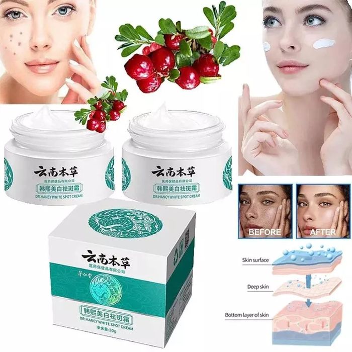 yyuz va tana uchun krem

 Quyosh va tashqi tasirlar natijasida qorayg