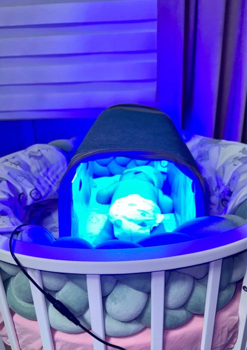 Лампа от желтушки