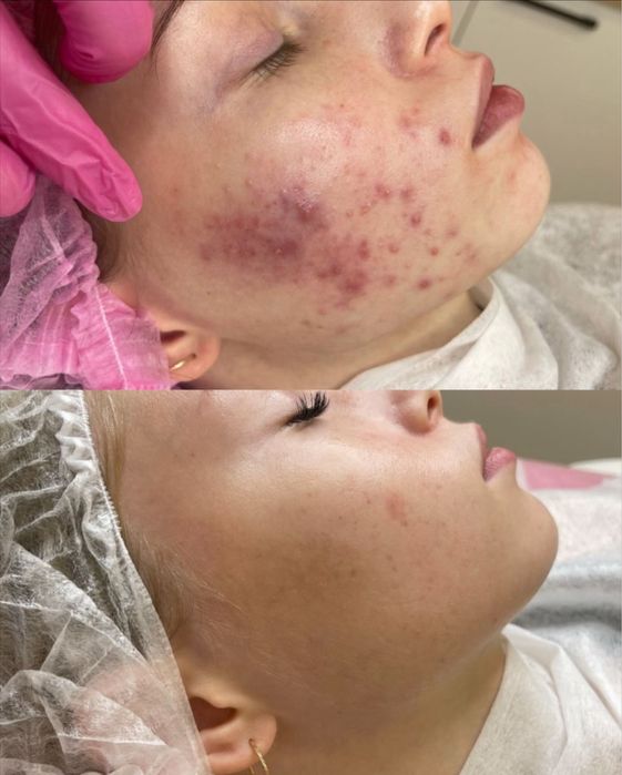 Косметолгия Мужинь и женшинь