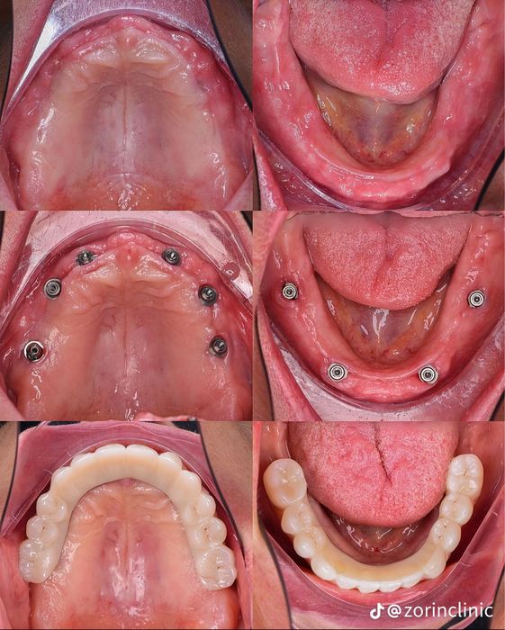 Обмен,бартер варианты !!!