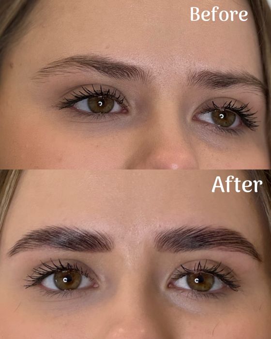 Laminare gene si sprancene