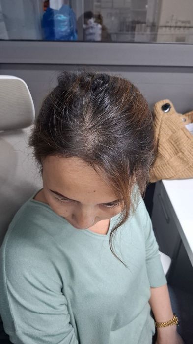 Kiprik narashka 100 min. soch boyash, ukladkaa