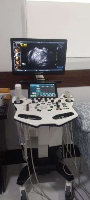 UZI apparat VINNO E 10  sotiladi