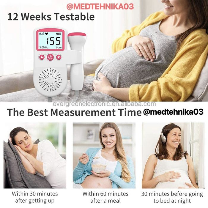 Фетальный Доплер оптом 150.000