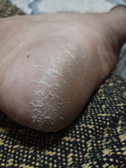 Er-xotinlar ortasidagi jinsiy aloqa almashinuvi