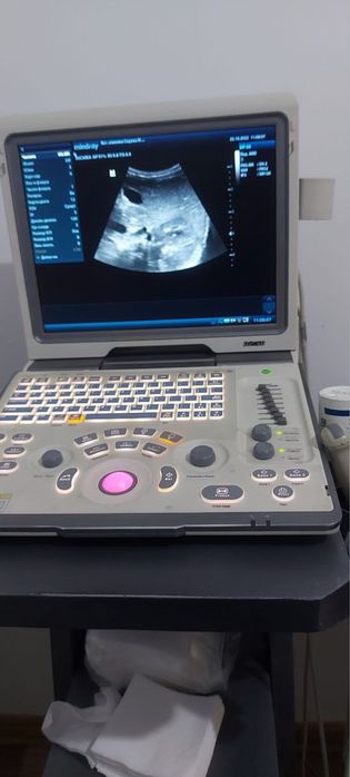 УЗИ аппарат Миндрай Dp-50
