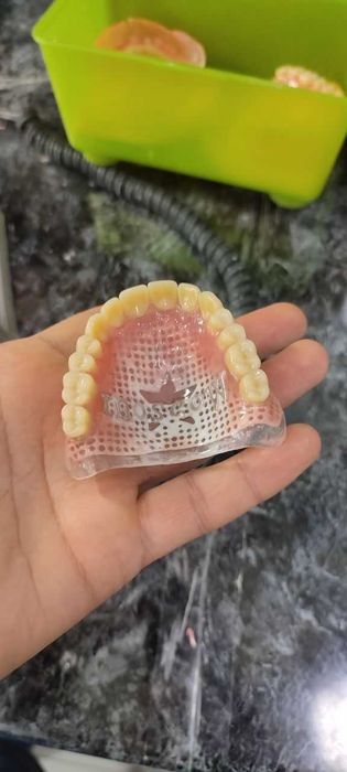 зубные протезы с гарантией