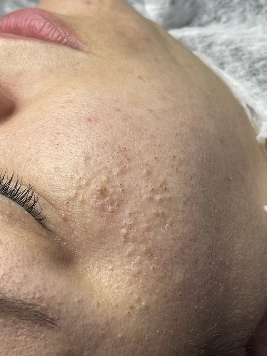 Косметолог Темиртау