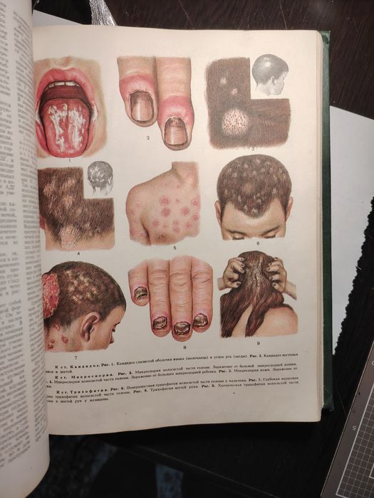 Медицинская Энциклопедия