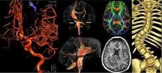 ВТОРО МНЕНИЕ ЗА КОМПЮТЪРНА ТОМОГРАФИЯ РЕНТГЕН СКЕНЕР ЯДРЕНО-МАГНИТЕН РЕЗОНАНС МАМОГРАФ.Разчитане на Образни Изследвания-КТ CT ЯМР MR Рентгенова снимка