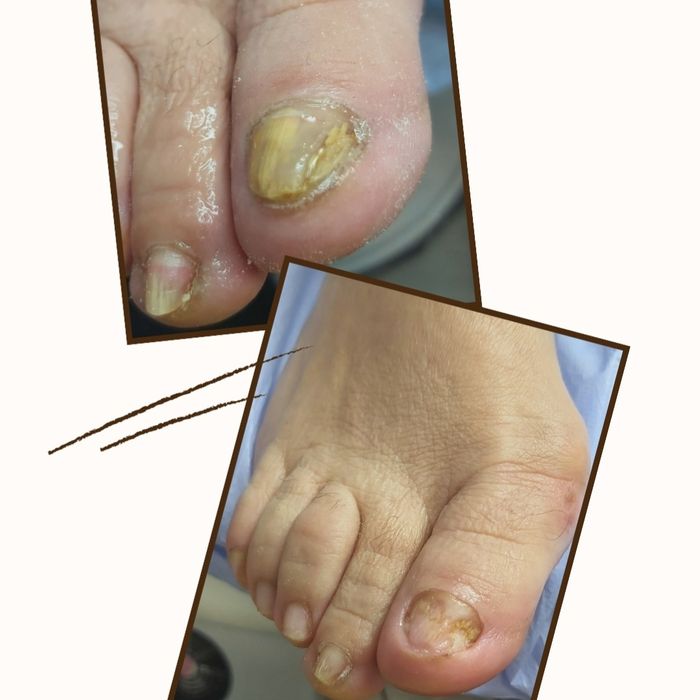 Pedichiura Kart Oradea