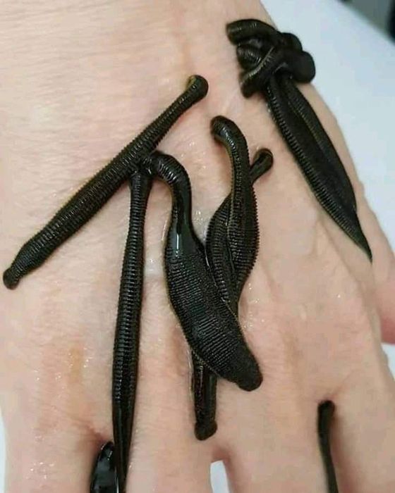 тиббий зулуклар медицинский пиявки