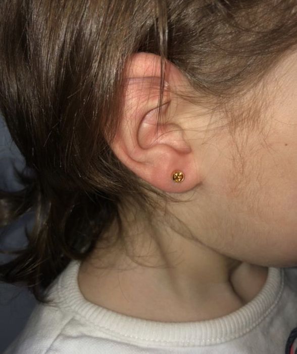 Montare cercei medicinali