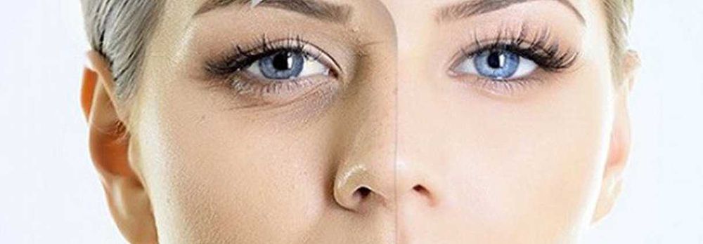 Плазмолифтинг, Plazmolifting в косметологии. Плазмотерапия.