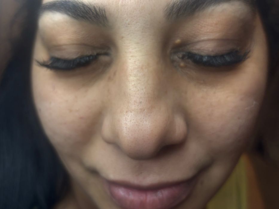 Extensi gene 1-3D soft si mega volume