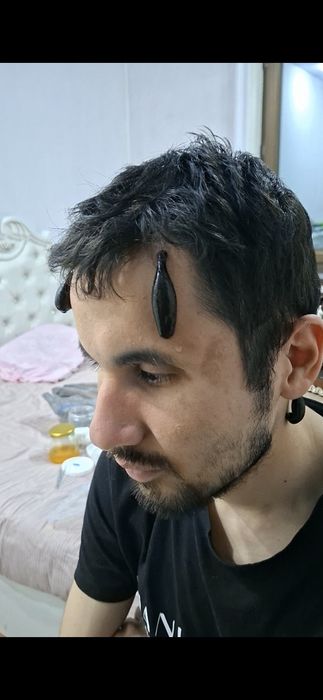 Xijoma v Zuluk muolaja xizmati