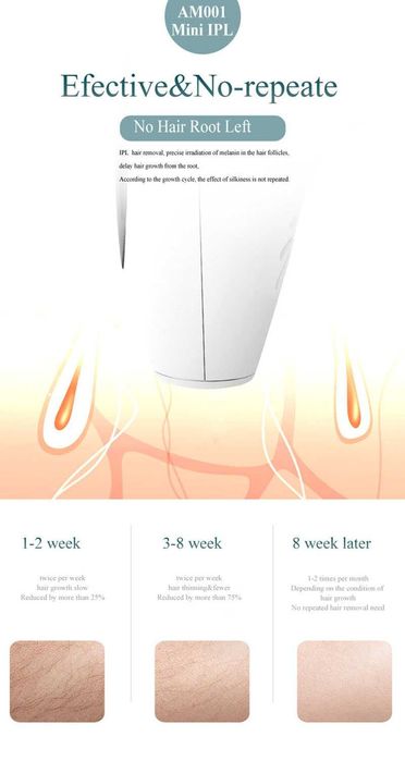 Фотоeпилатор /IPL / 900 000 импулса / Лазерен епилатор