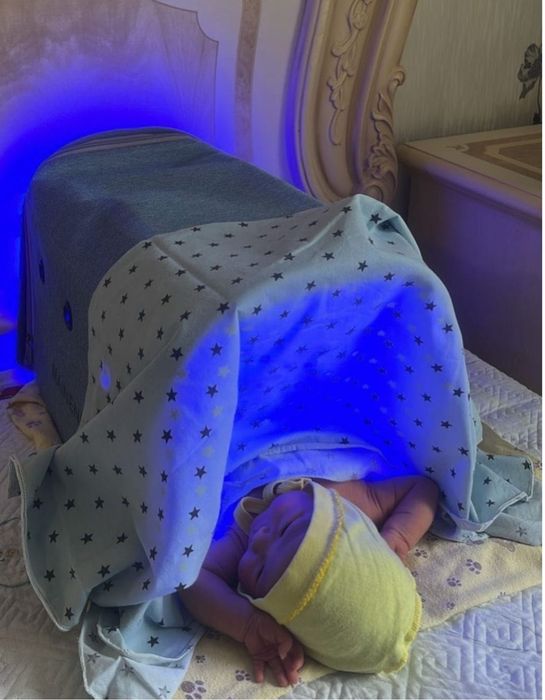 Лампа от желтушки