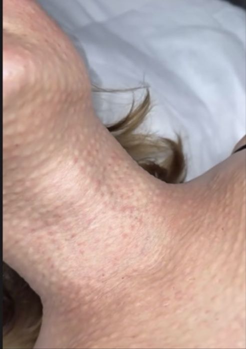 Требуются модели на косметологические процедуры