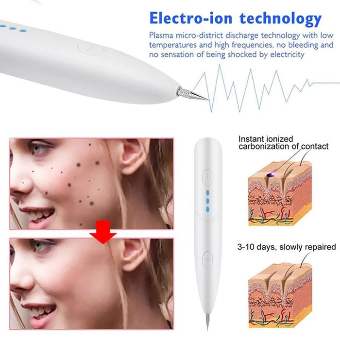 Plasma pen Dastavka bor