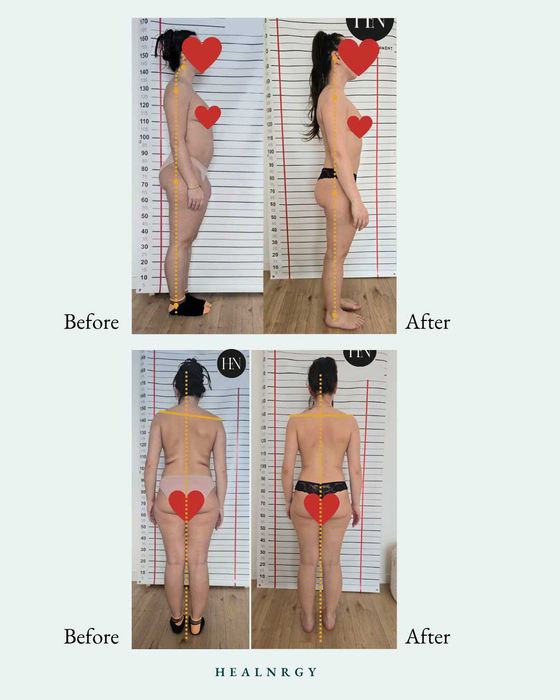 Acupunctură & Aliniament Postural Brașov