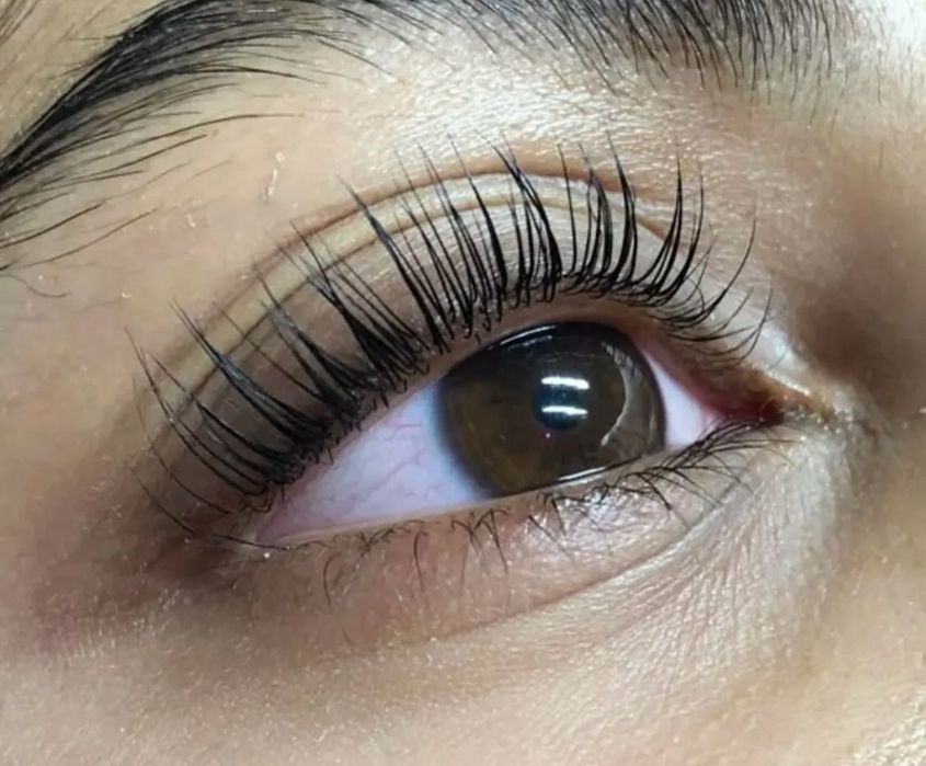 Әйелдер трусиктеріндегі сперматозоидтардың фотосы