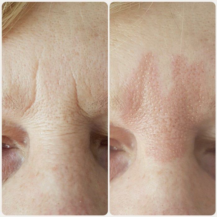 Супер Акция 5000 Татуаж бровей