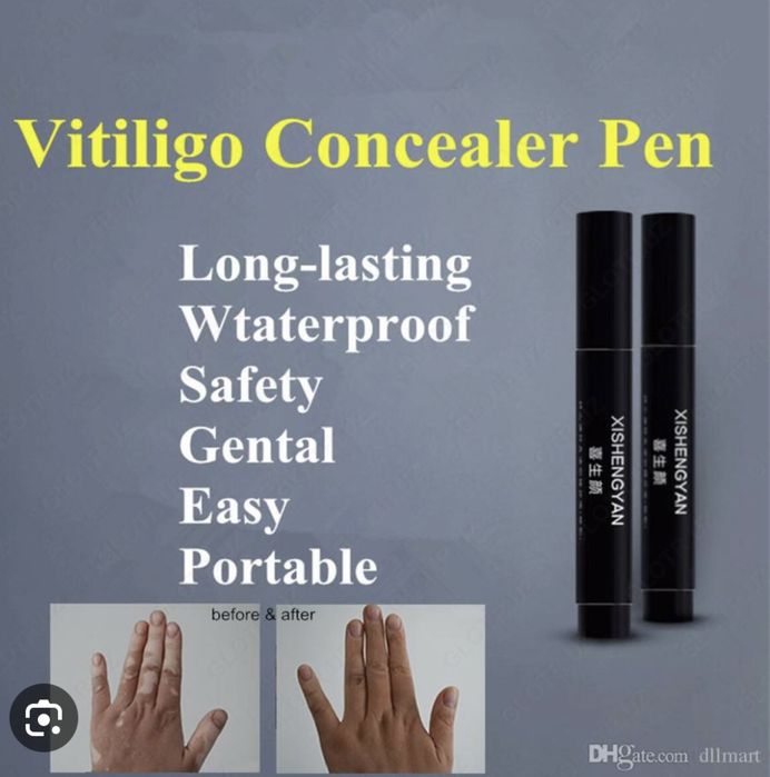 Vitiligo flomaster XISHENGYAN orginal kottasi