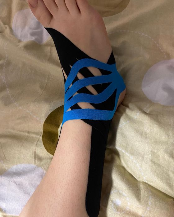 Kinetoterapie, Masaj, Chiropractică și Acupunctură (Dryneedling)