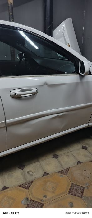 Avto vakum xizmati.  Duldan keying pachoqlarni tuğirlash xizmati